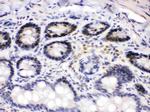 CDK4 Antibody in Immunohistochemistry (Paraffin) (IHC (P))