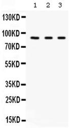 Complement Factor B Antibody in Western Blot (WB)