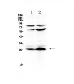 Factor D Antibody in Western Blot (WB)