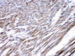 CHRNA5 Antibody in Immunohistochemistry (Paraffin) (IHC (P))