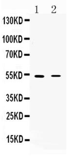 CHRNA5 Antibody in Western Blot (WB)