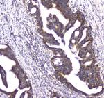 CLPX Antibody in Immunohistochemistry (Paraffin) (IHC (P))