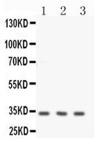 Calponin 1 Antibody in Western Blot (WB)