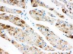 CPT1B Antibody in Immunohistochemistry (Paraffin) (IHC (P))