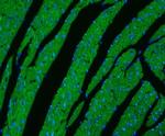 CPT1B Antibody in Immunohistochemistry (Paraffin) (IHC (P))