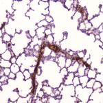 CRP Antibody in Immunohistochemistry (Paraffin) (IHC (P))