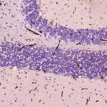 CRP Antibody in Immunohistochemistry (Paraffin) (IHC (P))