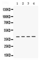 CK1 alpha Antibody in Western Blot (WB)