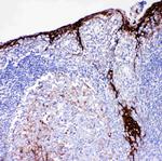 Cystatin A Antibody in Immunohistochemistry (Paraffin) (IHC (P))