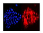 Cystatin A Antibody in Immunocytochemistry (ICC/IF)