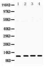 Cystatin B Antibody in Western Blot (WB)