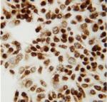 CtBP2 Antibody in Immunocytochemistry (ICC/IF)