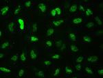 CtBP2 Antibody in Immunocytochemistry (ICC/IF)