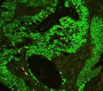 CtBP2 Antibody in Immunohistochemistry (Paraffin) (IHC (P))