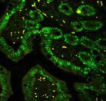 CtBP2 Antibody in Immunohistochemistry (Paraffin) (IHC (P))