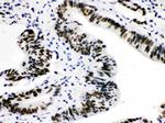 CtBP2 Antibody in Immunohistochemistry (Paraffin) (IHC (P))