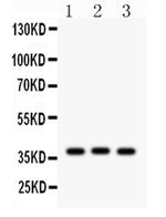 CTGF Antibody in Western Blot (WB)