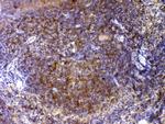 CTLA-4 (CD152) Antibody in Immunohistochemistry (Paraffin) (IHC (P))