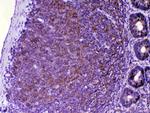 CTLA-4 (CD152) Antibody in Immunohistochemistry (Paraffin) (IHC (P))