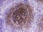 CTLA-4 (CD152) Antibody in Immunohistochemistry (Paraffin) (IHC (P))