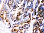 Cathepsin D Antibody in Immunohistochemistry (Paraffin) (IHC (P))