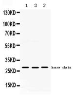 Cathepsin D Antibody in Western Blot (WB)