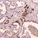 Cathepsin E Antibody in Immunohistochemistry (Paraffin) (IHC (P))