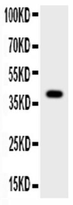 Cathepsin G Antibody in Western Blot (WB)