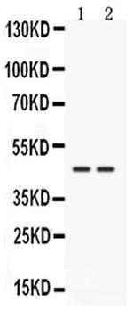 Cathepsin K Antibody in Western Blot (WB)