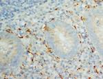 IL-8 (CXCL8) Antibody in Immunohistochemistry (Paraffin) (IHC (P))