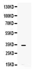 IL-8 (CXCL8) Antibody in Western Blot (WB)