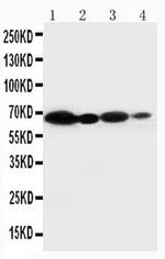 NOX2 Antibody in Western Blot (WB)