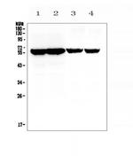 CYP17A1 Antibody in Western Blot (WB)