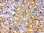 CYP27B1 Antibody in Immunohistochemistry (Paraffin) (IHC (P))