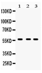 CYP27B1 Antibody in Western Blot (WB)