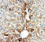 CYP2E1 Antibody in Immunohistochemistry (Paraffin) (IHC (P))