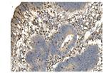 DAXX Antibody in Immunohistochemistry (Paraffin) (IHC (P))