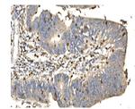 DAXX Antibody in Immunohistochemistry (Paraffin) (IHC (P))