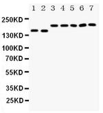 DCC Antibody in Western Blot (WB)