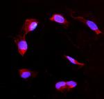 DDAH2 Antibody in Immunocytochemistry (ICC/IF)