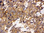 DDAH2 Antibody in Immunohistochemistry (Paraffin) (IHC (P))