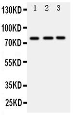 DDX4 Antibody in Western Blot (WB)