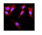 RIG-I Antibody in Immunocytochemistry (ICC/IF)
