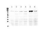 RIG-I Antibody in Western Blot (WB)