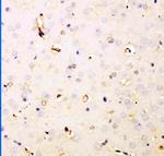 DHFR Antibody in Immunohistochemistry (Paraffin) (IHC (P))