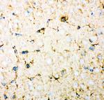 DHFR Antibody in Immunohistochemistry (Paraffin) (IHC (P))