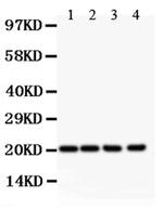 DHFR Antibody in Western Blot (WB)