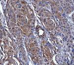 Dicer Antibody in Immunohistochemistry (Paraffin) (IHC (P))