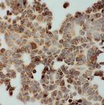 DLD Antibody in Immunocytochemistry (ICC/IF)