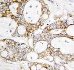 DLD Antibody in Immunohistochemistry (Paraffin) (IHC (P))